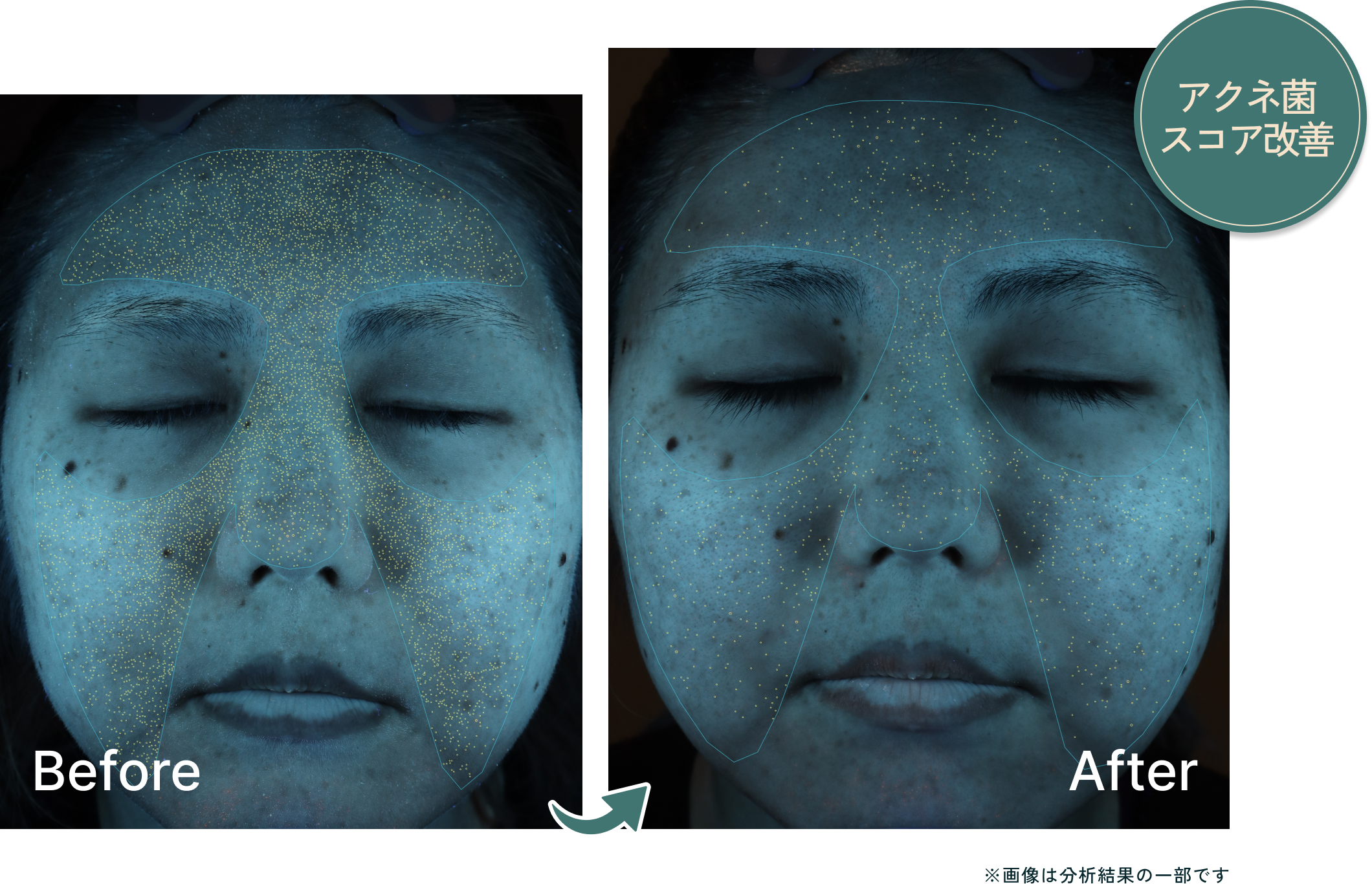 測定結果の変化